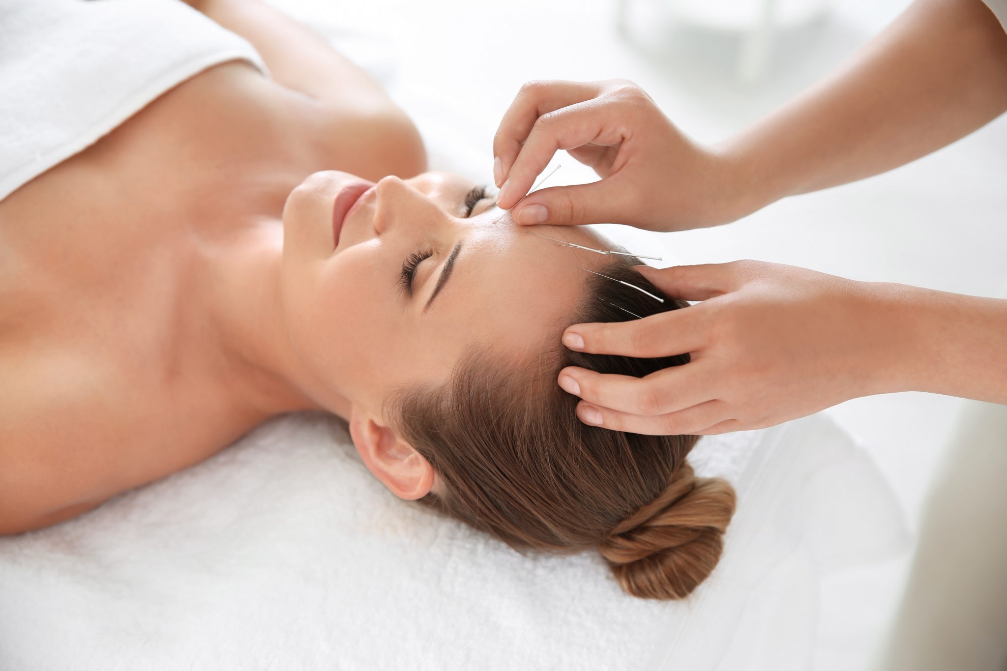 Acupuncture patient